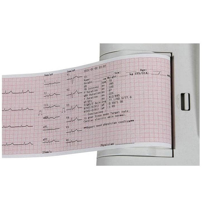 Appareil ECG Contec 600G