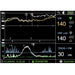 Moniteur fœtal Smart 3