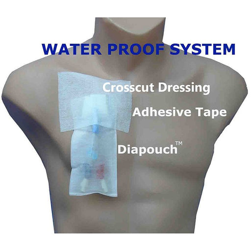 Pansement imperméable pour cathéter Diapouch