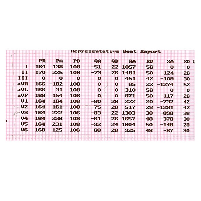 Papier ECG pour Cardio